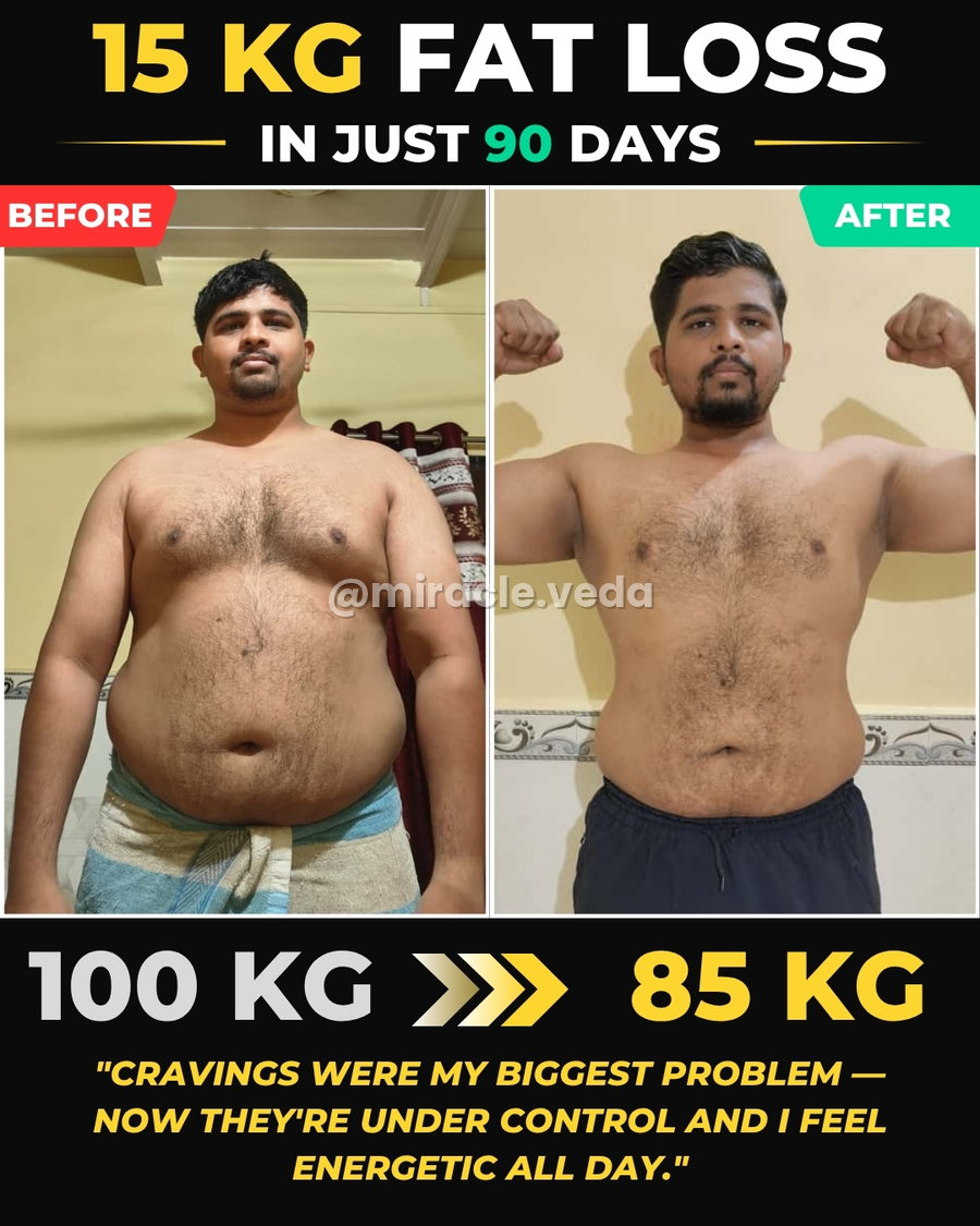Jayesh transformation — Miracle Veda client